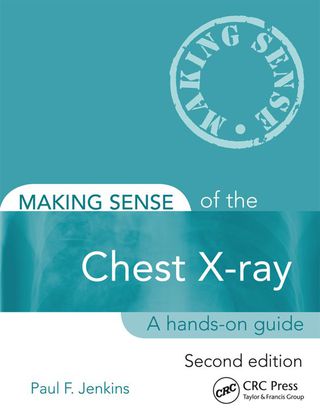 Making Sense of the Chest X-ray