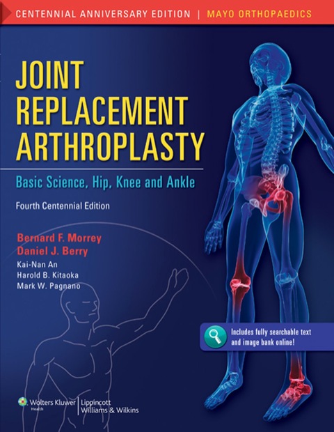 Cover image for book Joint Replacement Arthroplasty: Basic Science, Hip, Knee, and Ankle