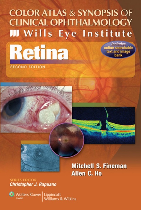 Cover image for book Color Atlas and Synopsis of Clinical Ophthalmology -- Wills Eye Institute -- Retina