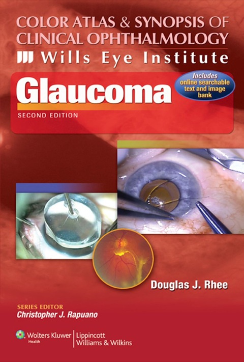 Cover image for book Color Atlas and Synopsis of Clinical Ophthalmology -- Wills Eye Institute -- Glaucoma