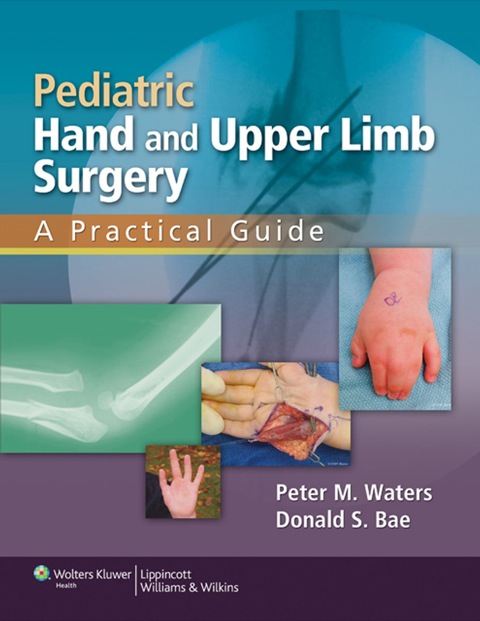 Cover image for book Pediatric Hand and Upper Limb Surgery