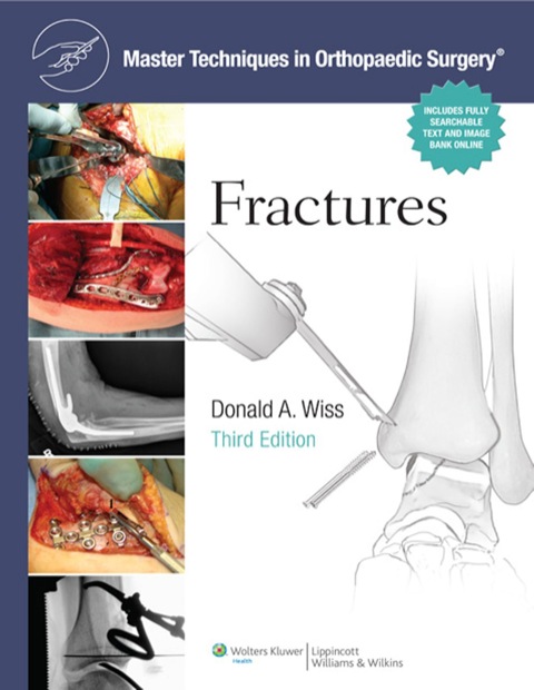 Cover image for book Master Techniques in Orthopaedic Surgery: Fractures