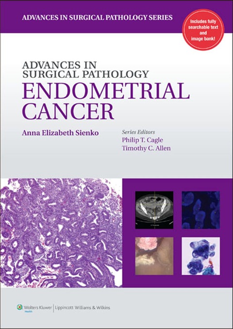 Cover image for book Advances in Surgical Pathology: Endometrial Carcinoma