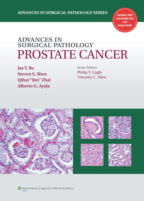 Cover image for book Advances in Surgical Pathology: Prostate Cancer