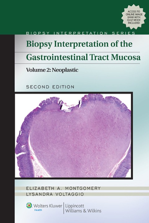 Cover image for book Biopsy Interpretation of the Gastrointestinal Tract Mucosa: Volume 2: Neoplastic