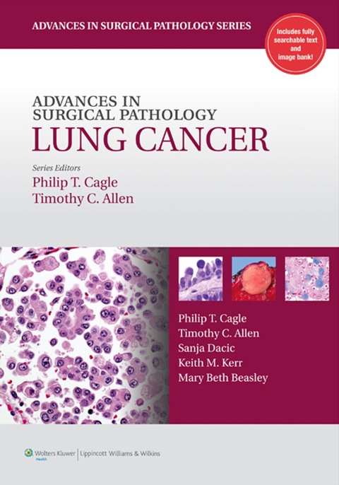 Cover image for book Advances in Surgical Pathology: Lung Cancer