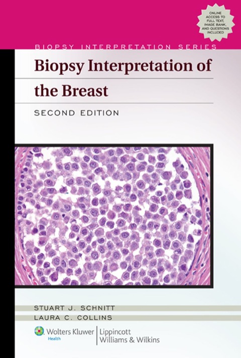 Cover image for book Biopsy Interpretation of the Breast