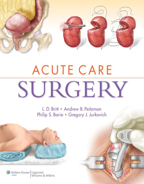 Cover image for book Acute Care Surgery
