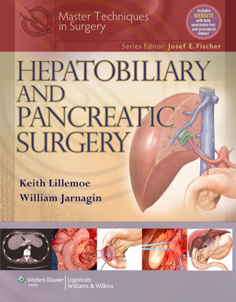 Cover image for book Master Techniques in Surgery: Hepatobiliary and Pancreatic Surgery