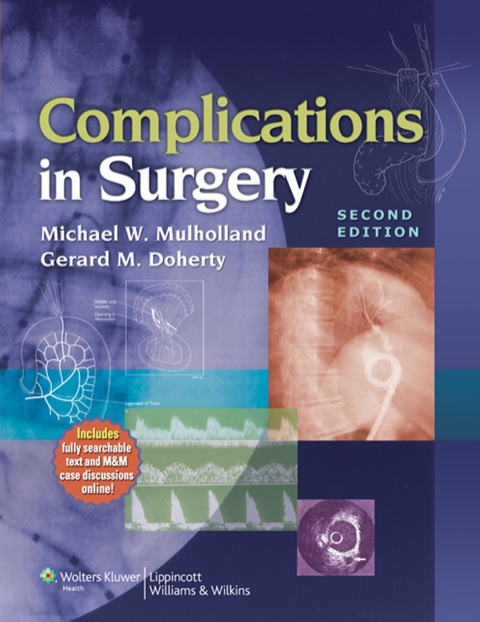 Cover image for book Complications in Surgery