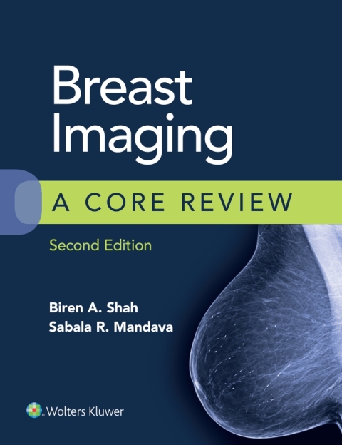 Cover image for book Breast Imaging: A Core Review