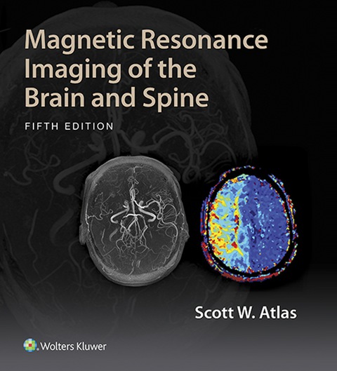 Cover image for book Magnetic Resonance Imaging of the Brain and Spine