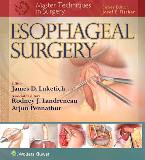 Cover image for book Master Techniques in Surgery: Esophageal Surgery