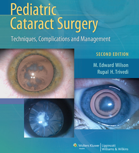 Cover image for book Pediatric Cataract Surgery