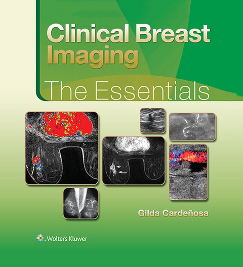 Cover image for book Clinical Breast Imaging: The Essentials