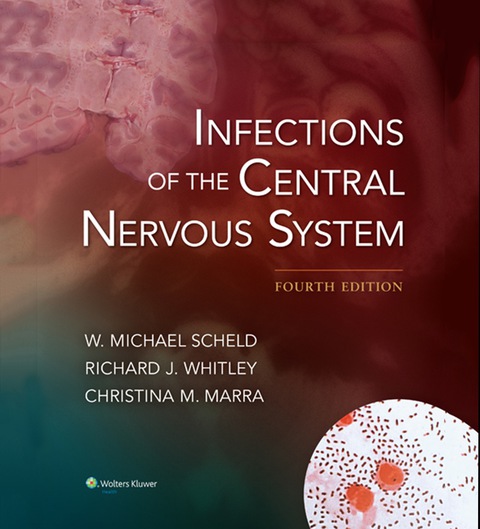 Cover image for book Infections of the Central Nervous System