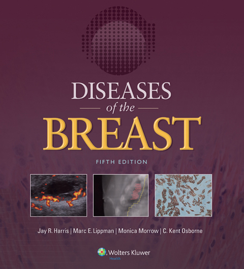 Cover image for book Diseases of the Breast