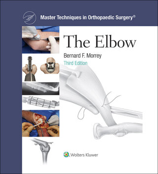 Master Techniques in Orthopaedic Surgery: The Elbow