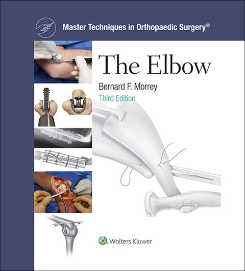 Cover image for book Master Techniques in Orthopaedic Surgery: The Elbow