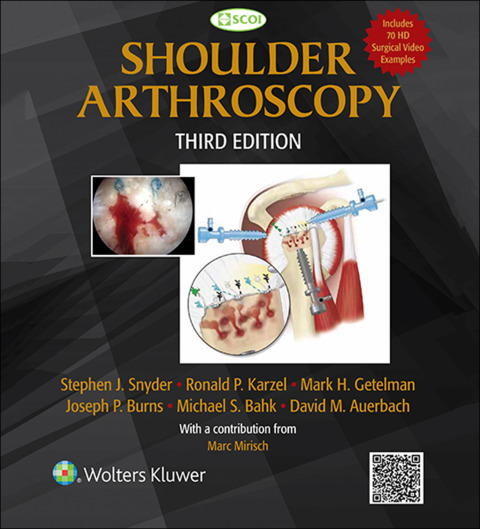 Cover image for book Shoulder Arthroscopy