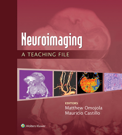 Cover image for book Neuroimaging: A Teaching File