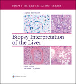 “Biopsy Interpretation of the Liver” (9781469887593)