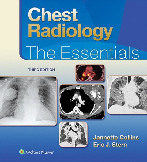 Cover image for book Chest Radiology: The Essentials