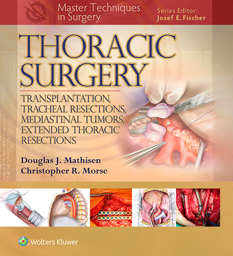 Cover image for book Master Techniques in Surgery: Thoracic Surgery: Transplantation, Tracheal Resections, Mediastinal Tumors, Extended Thoracic Resections