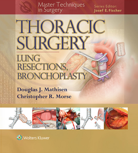 Cover image for book Thoracic Surgery: Lung Resections, Bronchoplasty