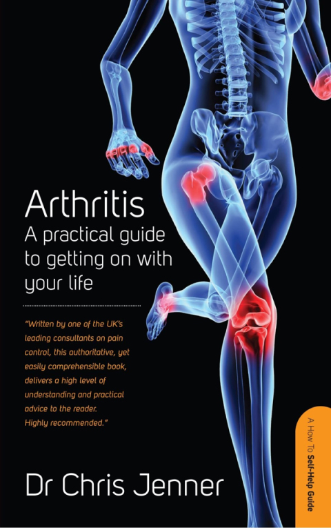 Cover image for book Arthritis