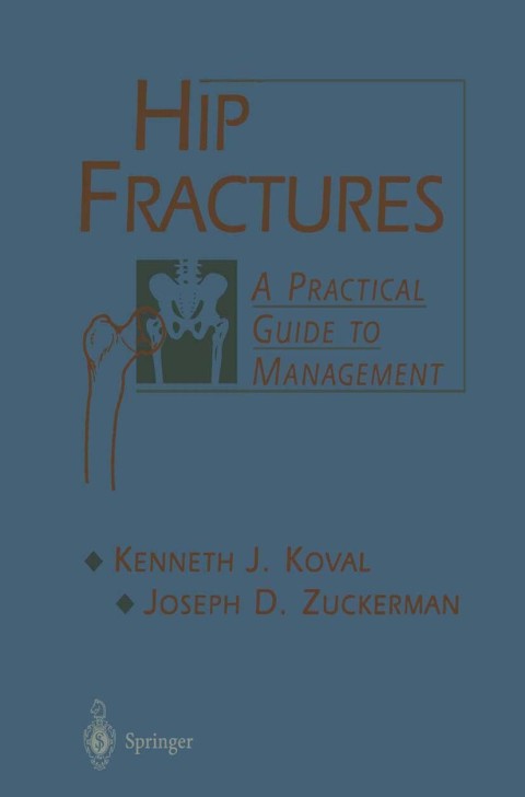 Cover image for book Hip Fractures