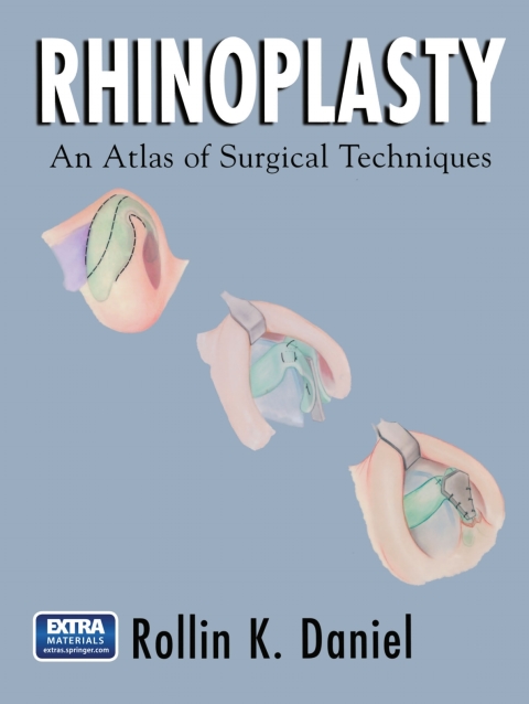 Cover image for book Rhinoplasty