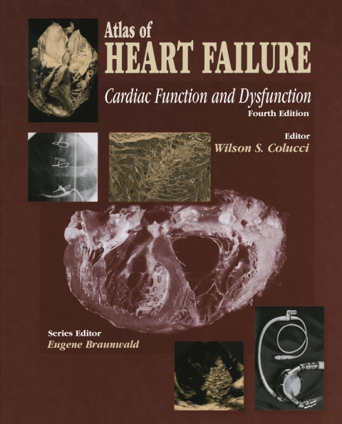 Cover image for book Atlas of HEART FAILURE