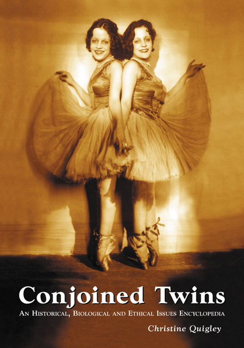 Cover image for book Conjoined Twins