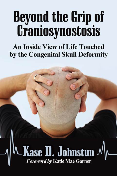 Cover image for book Beyond the Grip of Craniosynostosis