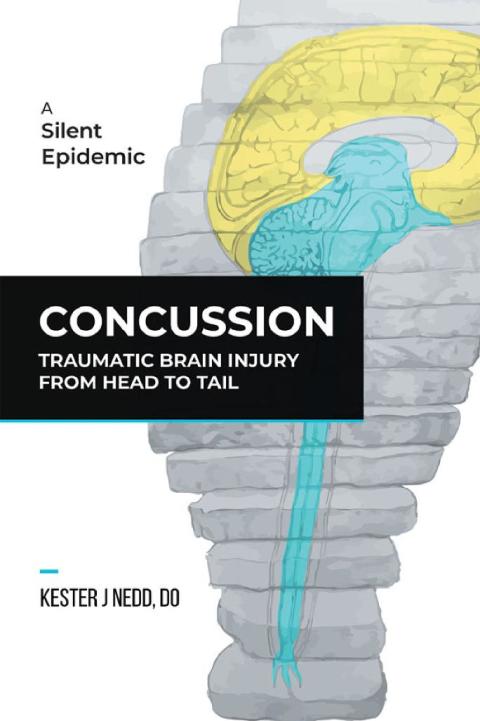 Cover image for book Concussion