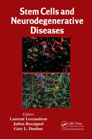 Stem Cells and Neurodegenerative Diseases