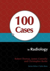 Cover image: 100 Cases in Radiology 1st edition 9781444123319