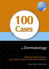 Cover image: 100 Cases in Dermatology 1st edition 9781444117936