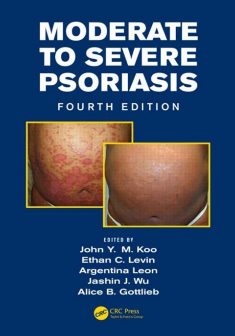 Cover image for book Mild to Moderate and Moderate to Severe Psoriasis (Set)