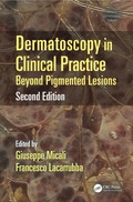 Dermatoscopy in Clinical Practice, Second Edition - Giuseppe Micali