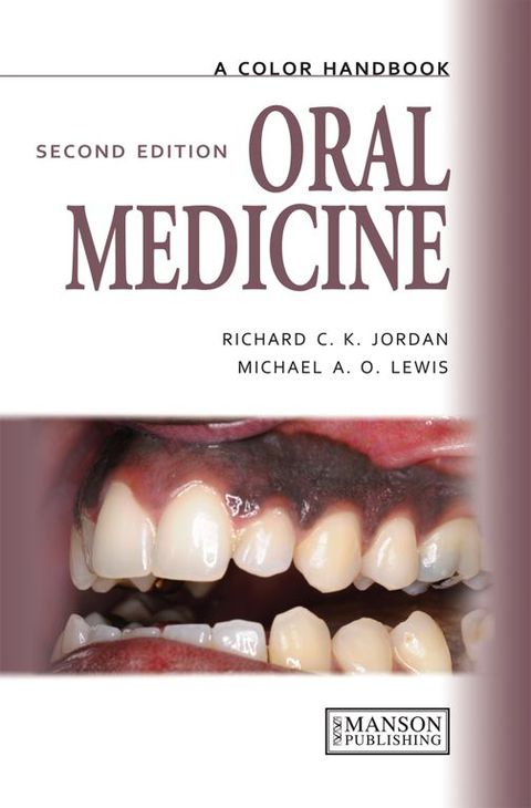 Cover image for book Oral Medicine