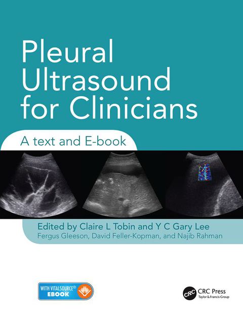 Cover image for book Pleural Ultrasound for Clinicians