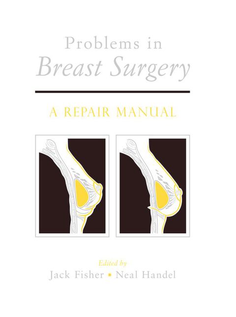 Cover image for book Problems in Breast Surgery