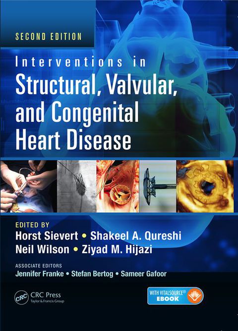 Cover image for book Interventions in Structural, Valvular and Congenital Heart Disease