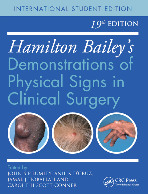 Hamilton Bailey's Physical Signs 