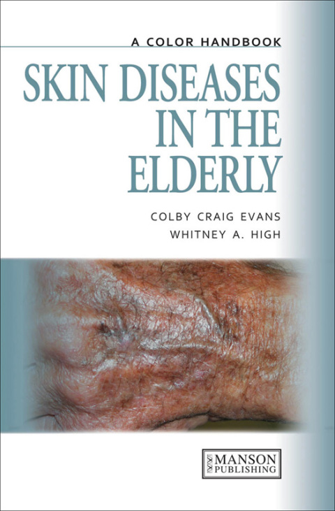 Cover image for book Skin Diseases in the Elderly