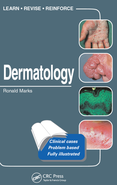 Cover image for book Dermatology
