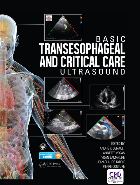 Cover image for book Basic Transesophageal and Critical Care Ultrasound
