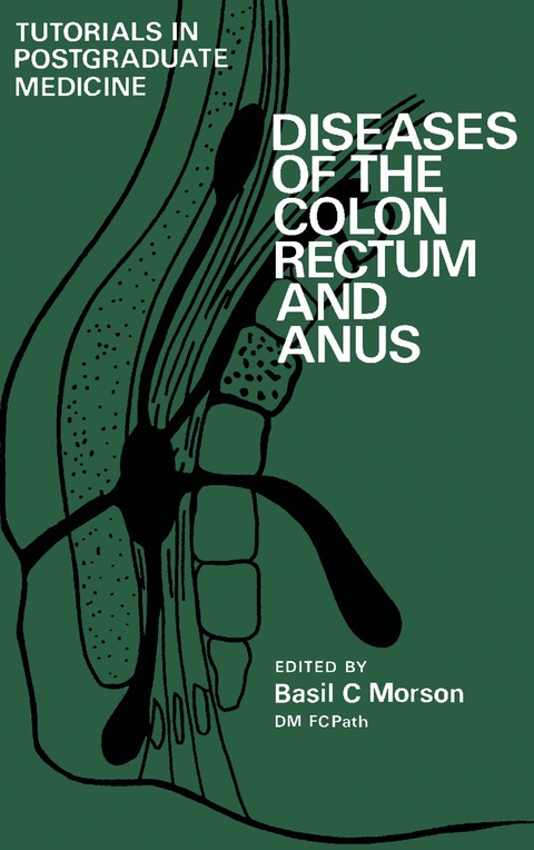Cover image for book Diseases of the Colon, Rectum and Anus